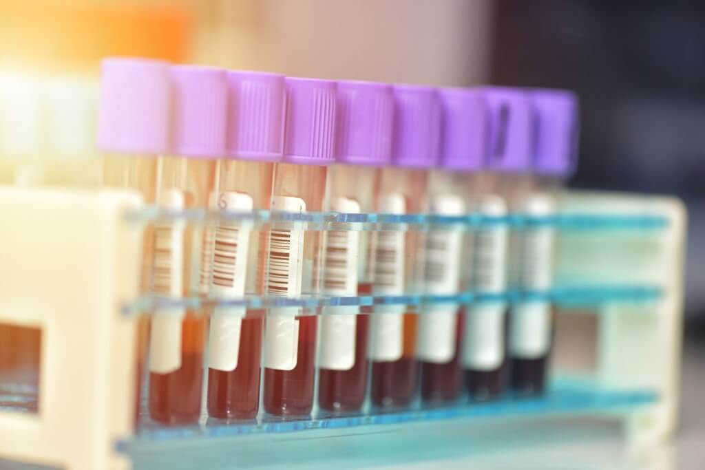 Robot to transport blood specimens